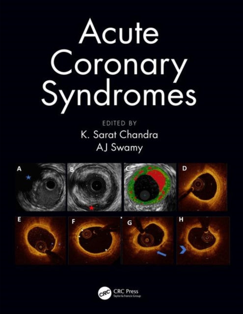 Book cover of: Acute Coronary Syndromes. By: K. Sarat Chandra