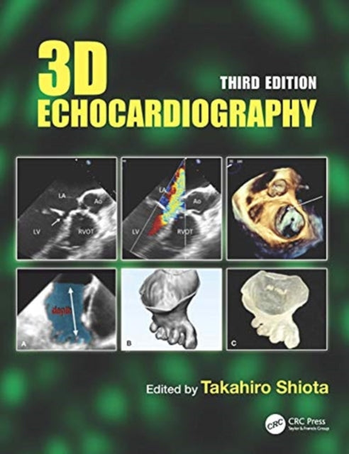 3D Echocardiography
