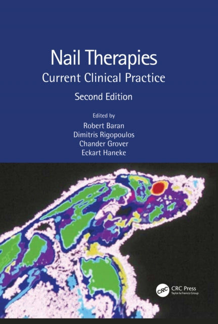 Book cover of: Nail Therapies. By: R. Baran