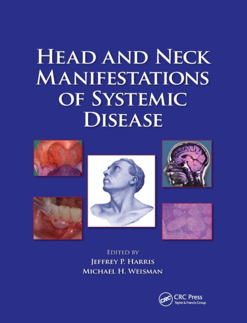 Book cover of: Head and Neck Manifestations of Systemic Disease