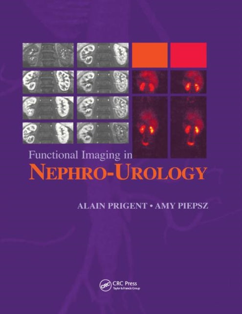 Book cover of: Functional Imaging in Nephro-Urology. By: Alain Prigent