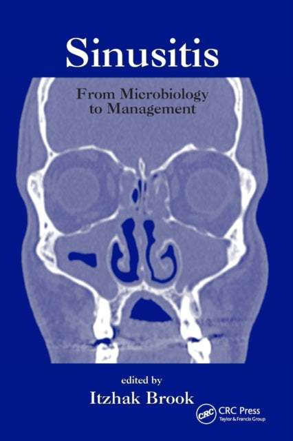 Book cover of: Sinusitis. By: Itzhak Brook