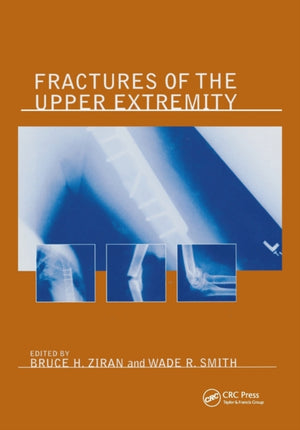Fractures of the Upper Extremity
