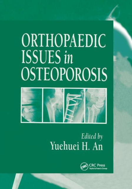 Book cover of: Orthopaedic Issues in Osteoporosis
