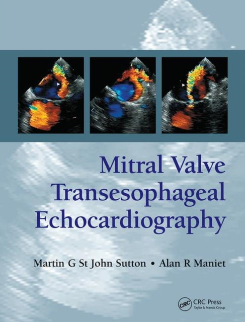 Book cover of: Mitral Valve Transesophageal Echocardiography. By: Martin G. St. John Sutton