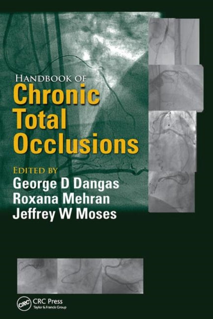 Book cover of: Handbook of Chronic Total Occlusions. By: Roxana Mehran