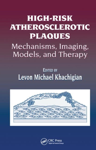 Book cover of: High-Risk Atherosclerotic Plaques. By: Levon Michael Khachigian