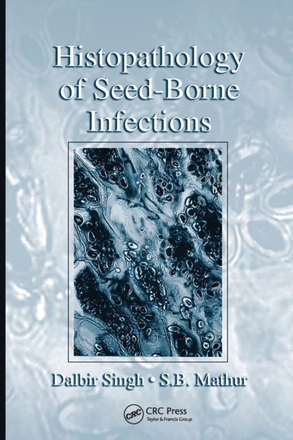 Book cover of: Histopathology of Seed-Borne Infections