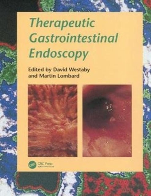 Book cover of: Therapeutic Gastrointestinal Endoscopy