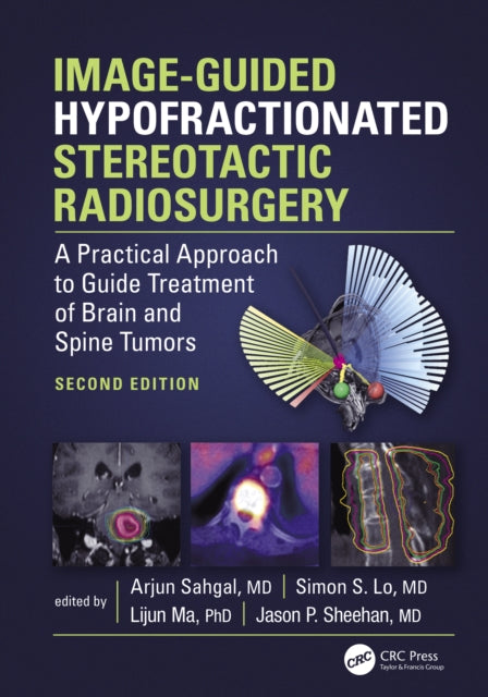 Book cover of: Image-Guided Hypofractionated Stereotactic Radiosurgery
