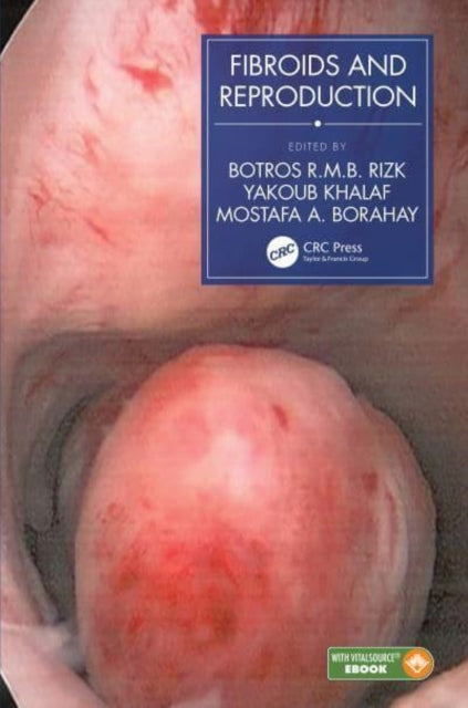 Book cover of: Fibroids and Reproduction. By: Botros R. M. B. Rizk