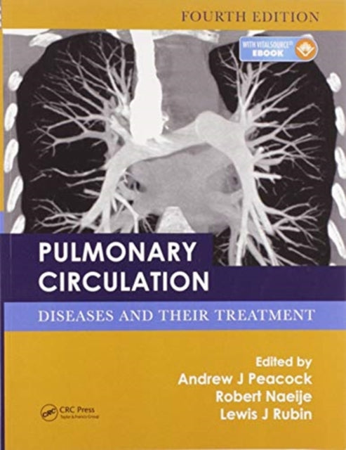 Book cover of: Pulmonary Circulation. By: A. J. Peacock