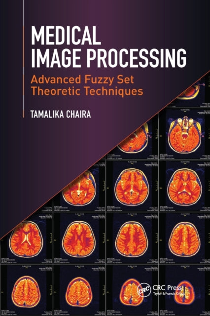 Book cover of: Medical Image Processing. By: Tamalika Chaira