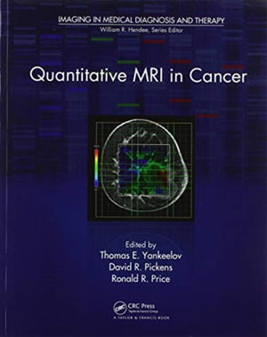 Quantitative MRI in Cancer