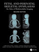 Book cover of: Fetal and Perinatal Skeletal Dysplasias. By: Christine M. Hall