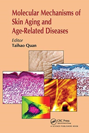 Molecular Mechanisms of Skin Aging and Age-Related Diseases