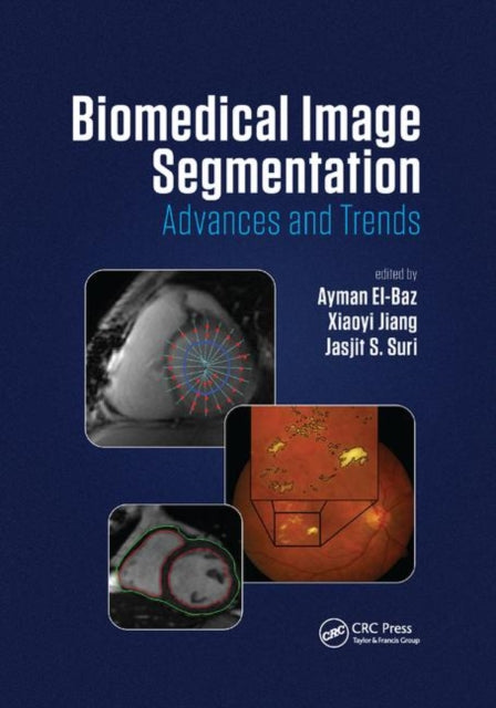 Book cover of: Biomedical Image Segmentation. By: Ayman El-Baz