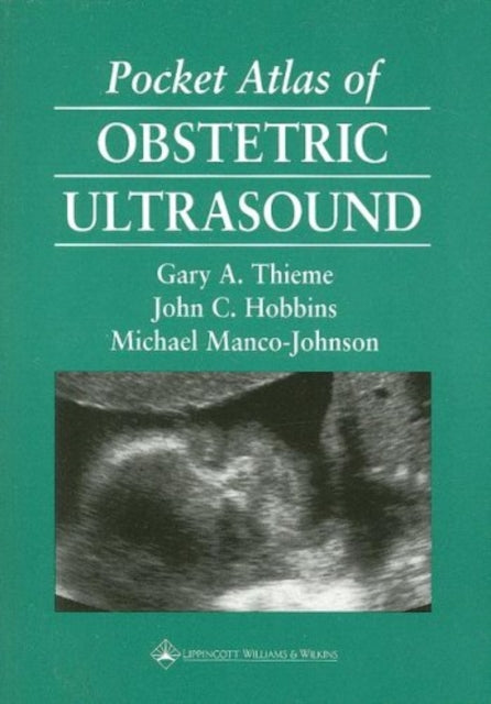 Book cover of: Pocket Atlas of Obstetric Ultrasound