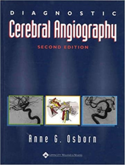 Book cover of: Diagnostic Cerebral Angiography