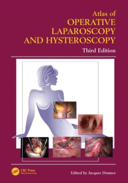 Book cover of: Atlas of Operative Laparoscopy and Hysteroscopy. By: Jacques Donnez