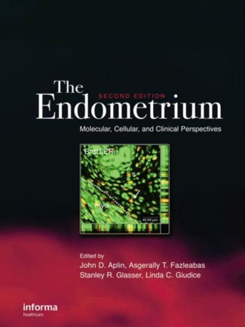 Book cover of: Endometrium