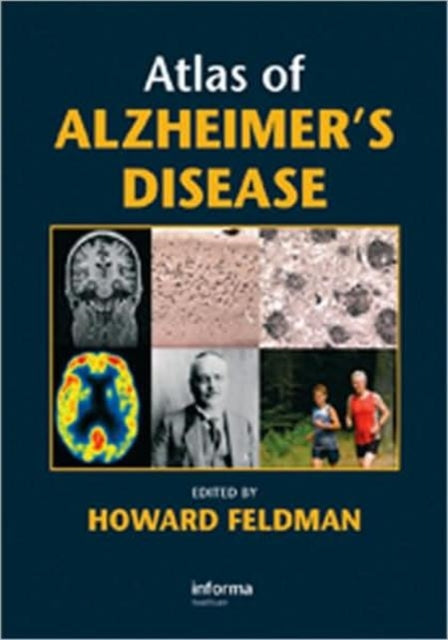 Book cover of: Atlas of Alzheimer's Disease. By: Howard Feldman