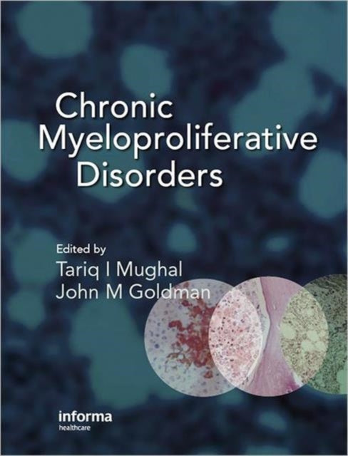 Book cover of: Chronic Myeloproliferative Disorders