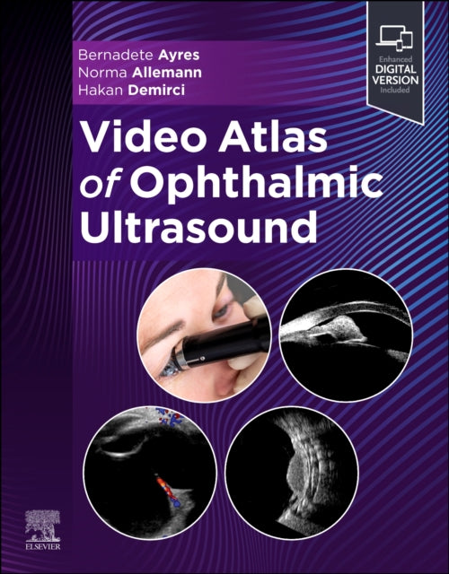 Book cover of: Video Atlas of Ophthalmic Ultrasound