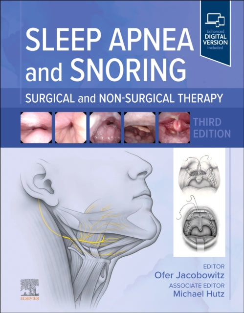 Book cover of: Sleep Apnea and Snoring