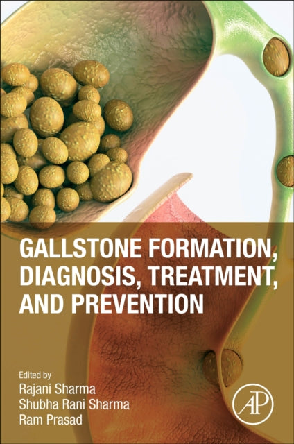 Book cover of: Gallstone Formation, Diagnosis, Treatment and Prevention