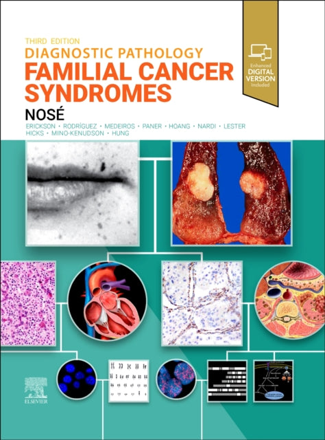 Book cover of: Diagnostic Pathology: Familial Cancer Syndromes. By: Vania Nosé