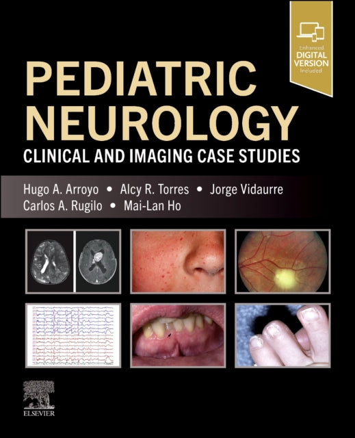 Book cover of: Pediatric Neurology