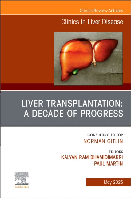 Book cover of: Liver Transplantation: A Decade of Progress, An Issue of Clinics in Liver Disease
