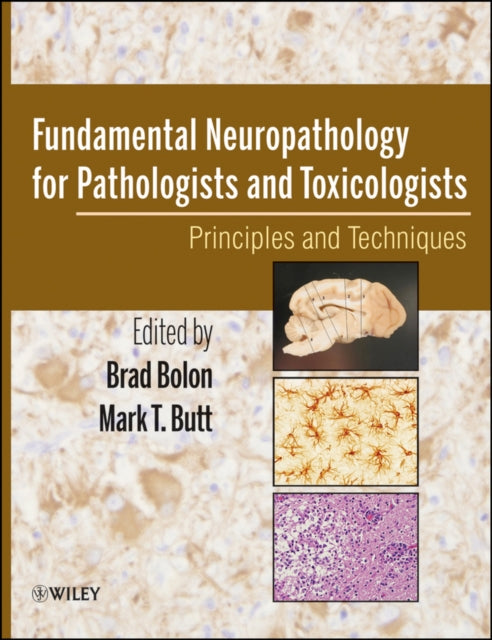 Book cover of: Fundamental Neuropathology for Pathologists and Toxicologists. By: Brad Bolon