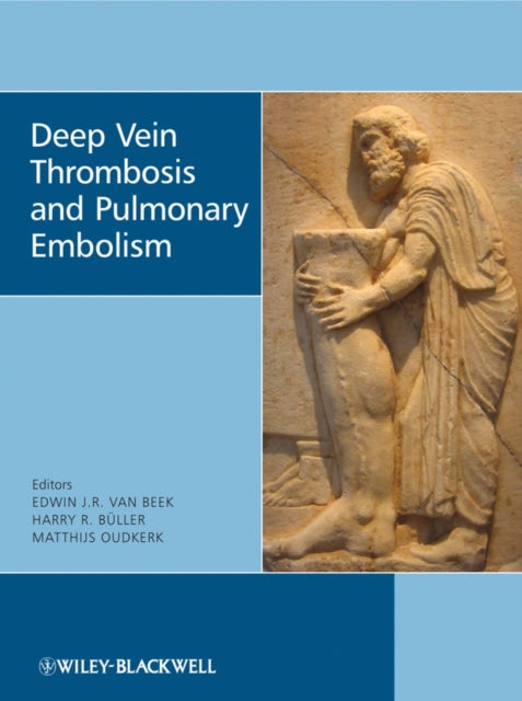 Book cover of: Deep Vein Thrombosis and Pulmonary Embolism