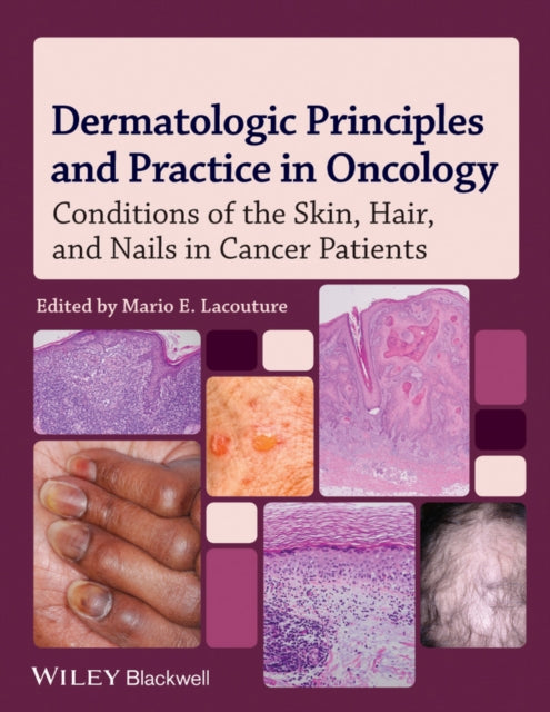 Book cover of: Dermatologic Principles and Practice in Oncology