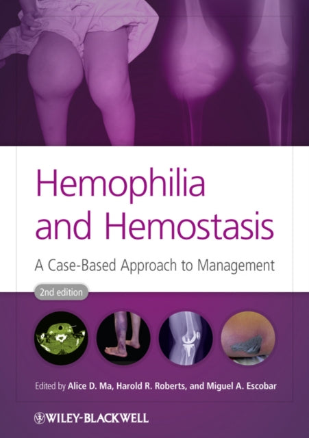 Hemophilia and Hemostasis
