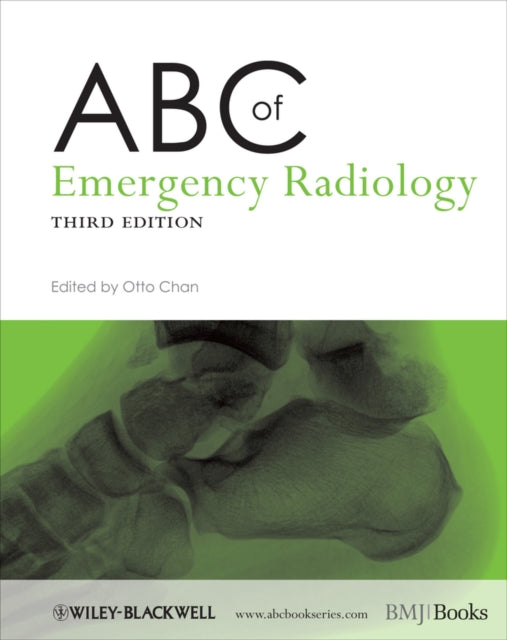 Book cover of: ABC of Emergency Radiology. By: Otta Chan