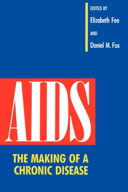 Book cover of: AIDS