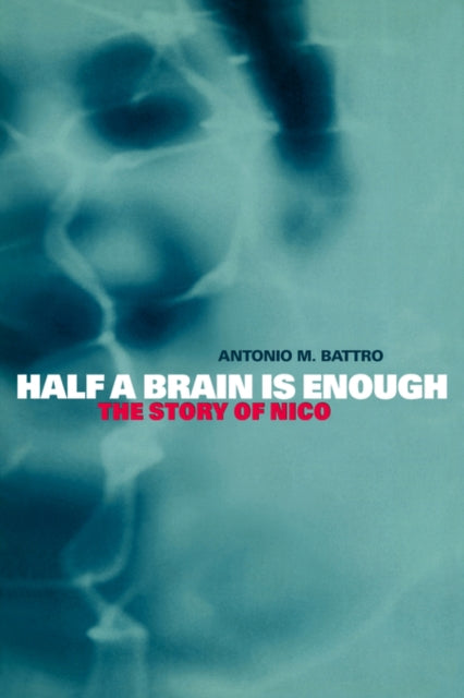 Book cover of: Half a Brain is Enough. By: Antonio M. Battro