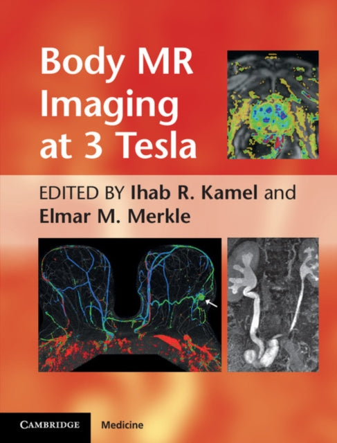 Book cover of: Body MR Imaging at 3 Tesla. By: Ihab R. Kamel