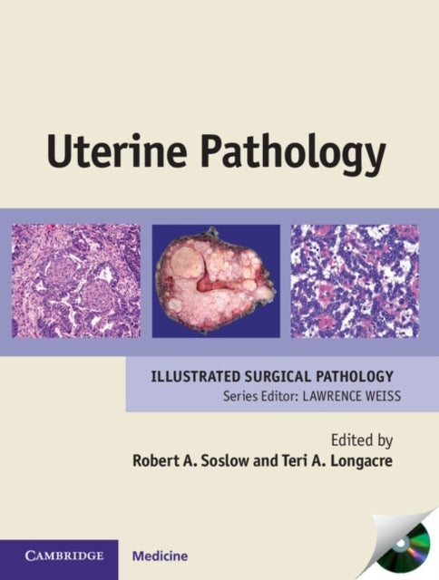 Book cover of: Uterine Pathology. By: Robert A. Soslow