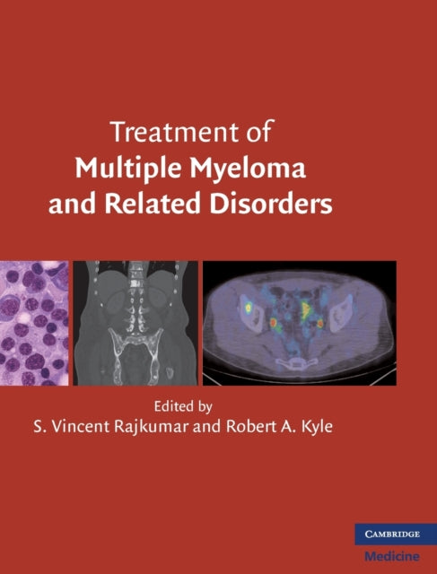 Book cover of: Treatment of Multiple Myeloma and Related Disorders
