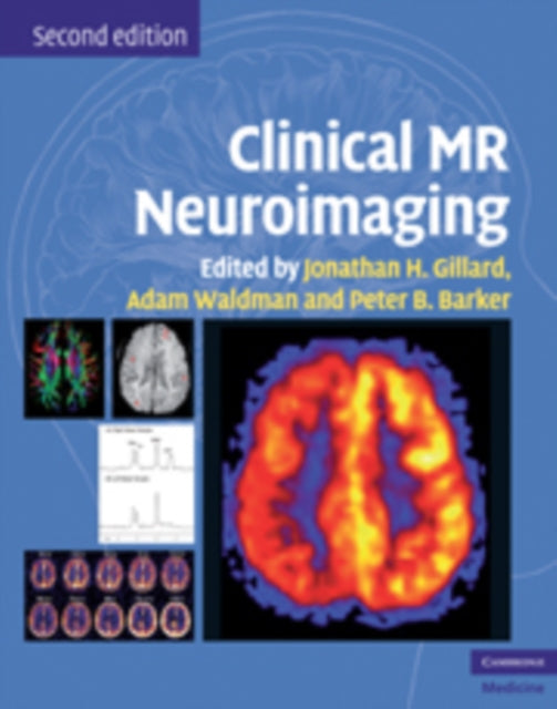 Book cover of: Clinical MR Neuroimaging. By: Jonathan H. Gillard