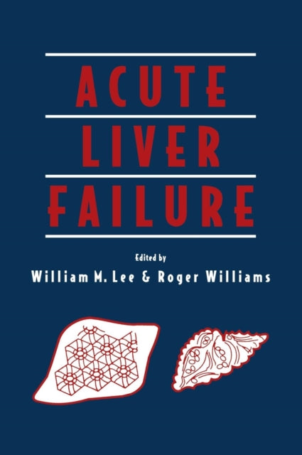 Book cover of: Acute Liver Failure