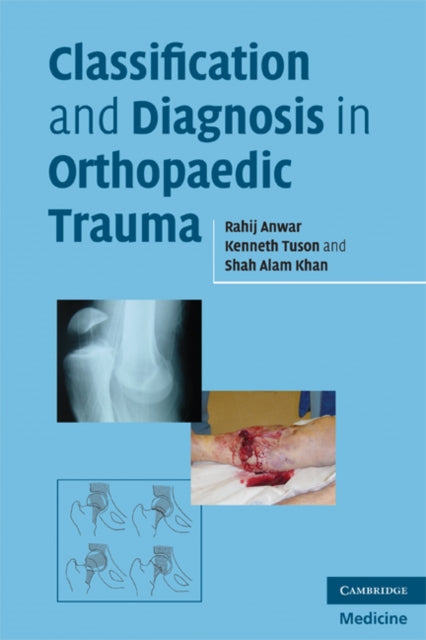 Book cover of: Classification and Diagnosis in Orthopaedic Trauma