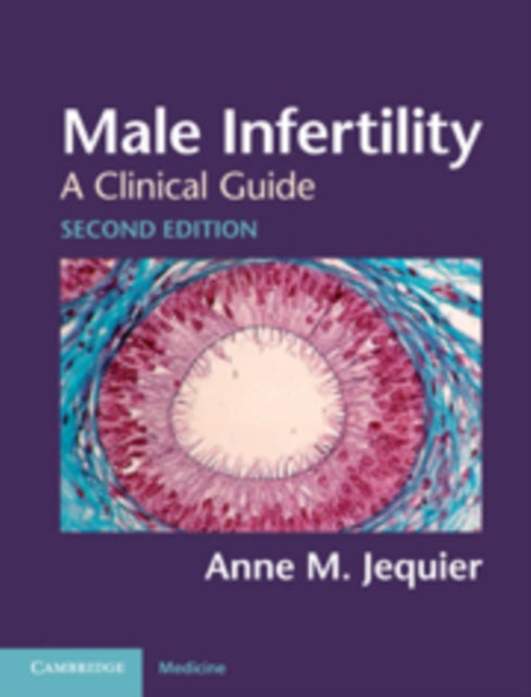 Book cover of: Male Infertility