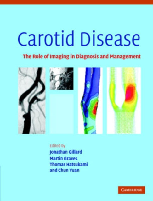 Book cover of: Carotid Disease