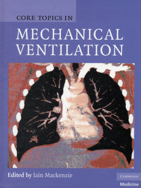 Book cover of: Core Topics in Mechanical Ventilation. By: Iain Mackenzie