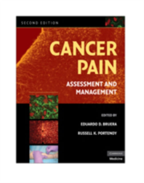Book cover of: Cancer Pain